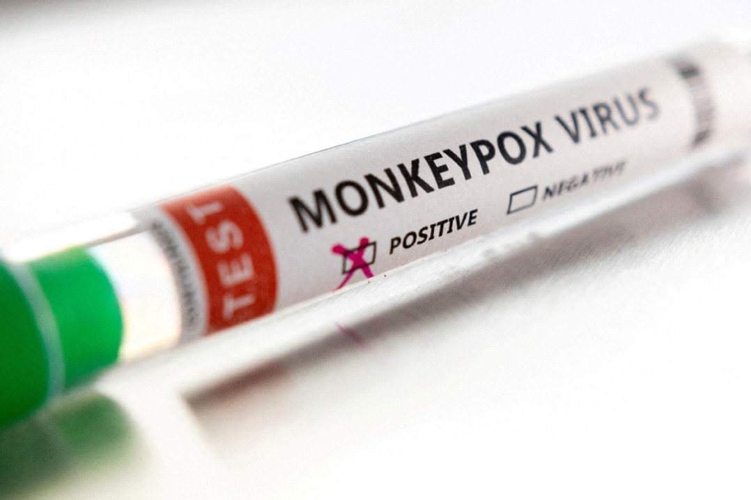 Monkeypox cases in Guangdong detailed in study