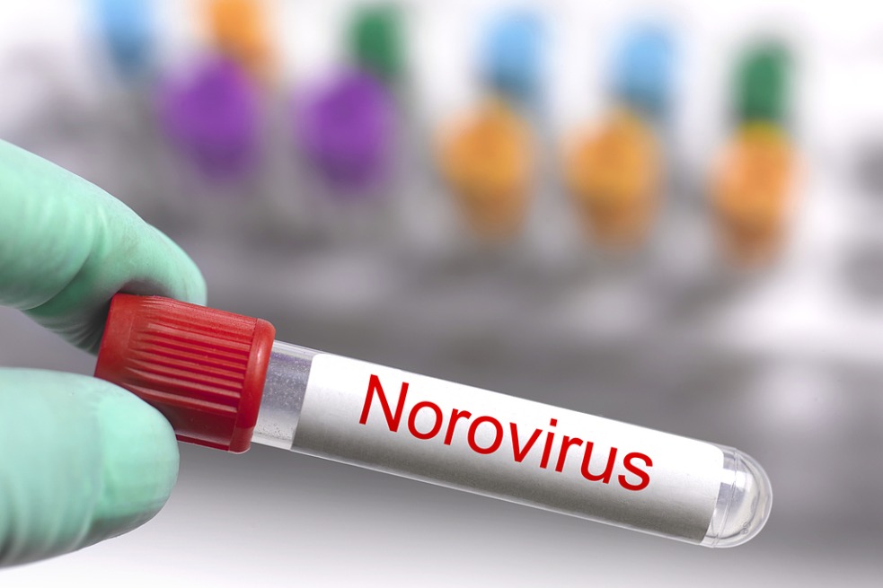 Guideline aims to curb spread of norovirus