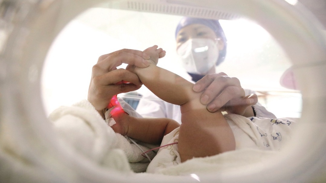 Saving baby Rourou: case highlights challenges of premature births