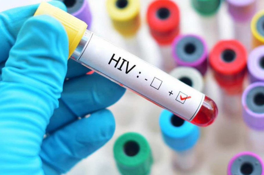 HIV Infections Decline in Dehong Despite Border Challenges, Study Finds