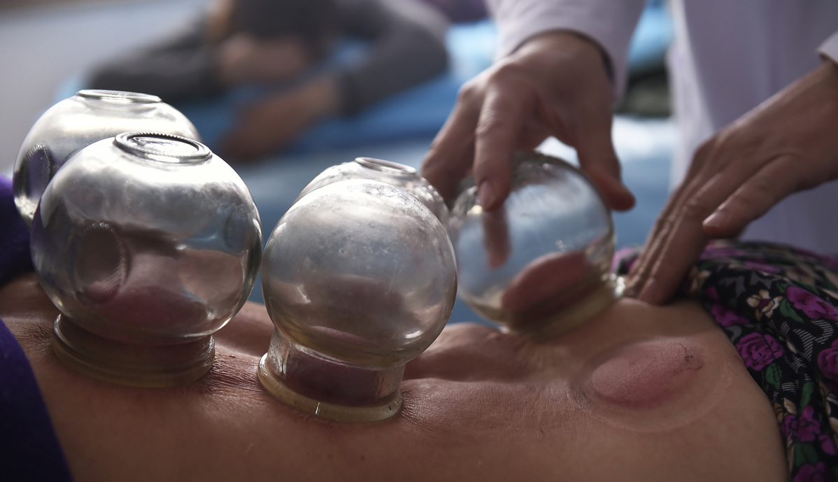 TCM therapy: Cupping - Chinadaily.com.cn