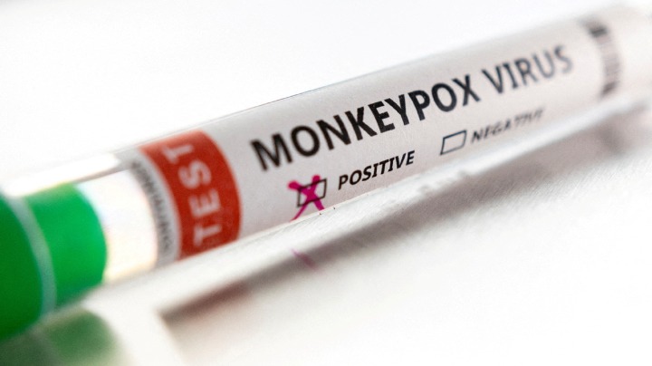 Travel heightens monkeypox risks in Asia, experts say - Vimarsana News