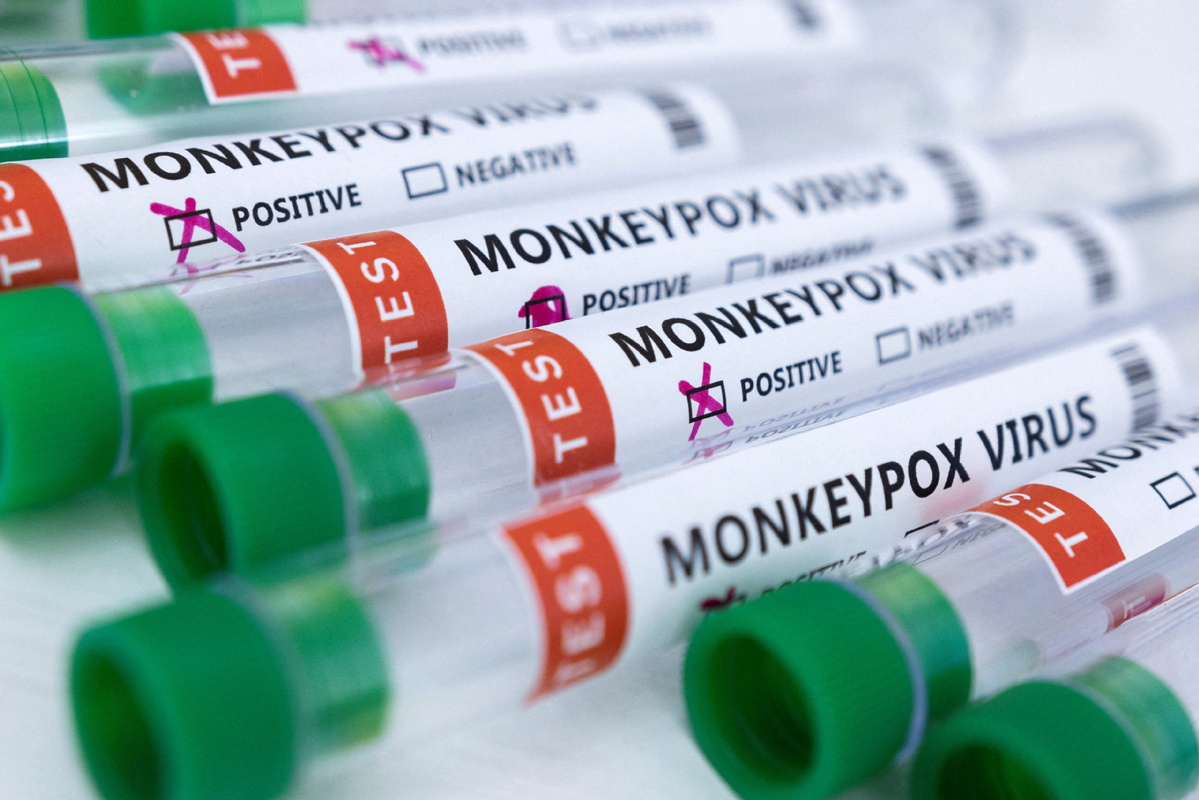 Brote de viruela del mono en varios países no es una emergencia de salud pública: OMS